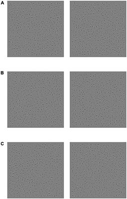 Event-Related Potential Assessment of Visual Perception Abnormality in Patients With Obstructive Sleep Apnea: A Preliminary Study